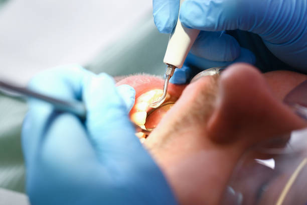 Best After-Hours Emergency Dentist in Chisholm, ME