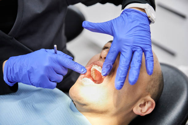 Best Emergency Tooth Extraction in Chisholm, ME